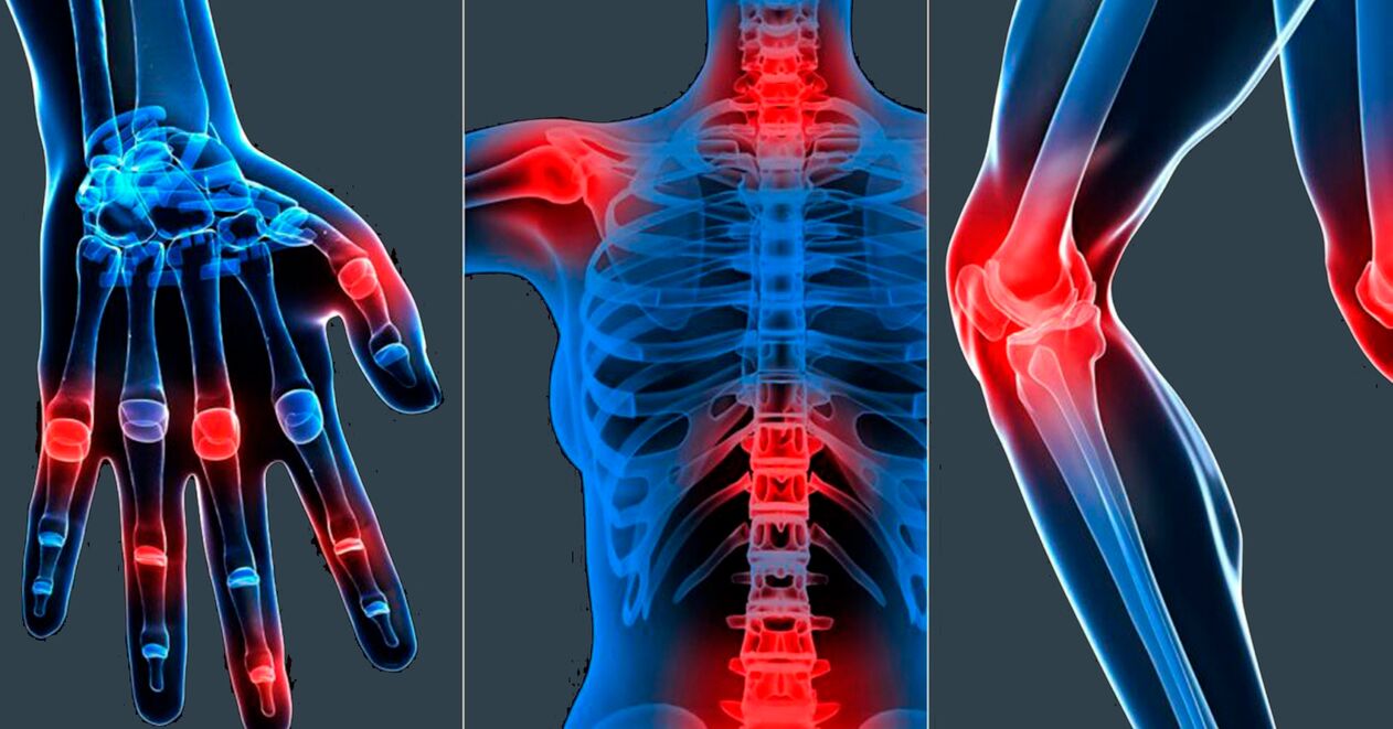 Indicacións para o uso do extracto de Boswellia en cápsulas